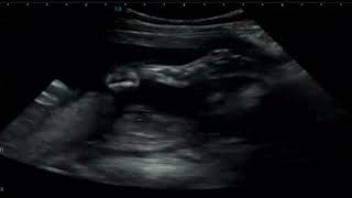 Our Baby Echo Part 6