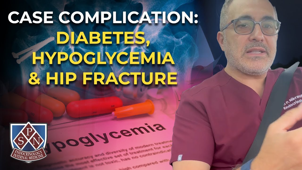 Drive Series Case Complication Diabetes hypoglycemia and Hip fracture