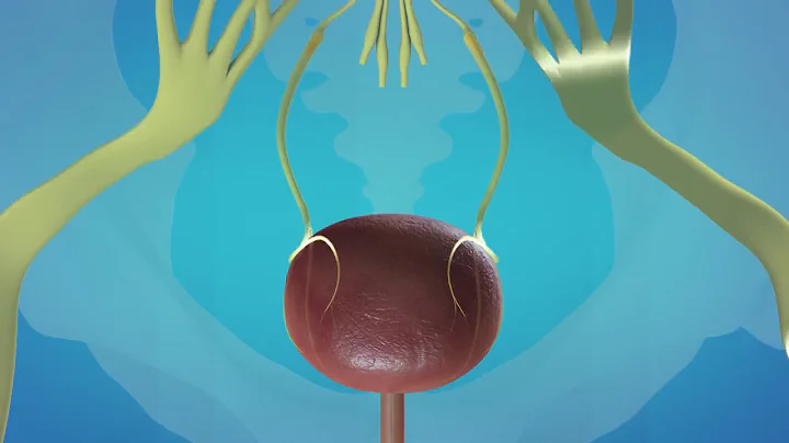 Percutaneous Tibial Nerve Stimulation PTNS for Overactive Bladder