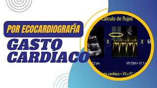 💡💚GASTO CARDÍACO por ECOCARDIOGRAFÍA [Paso a Paso]