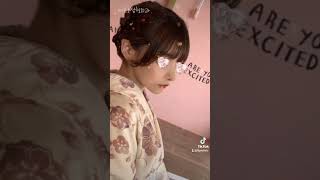 에프오성형외과 윤곽경곽 | 튀어나온광대와 꺼져보이는 볼 사각턱도 커보여요 ㅠ