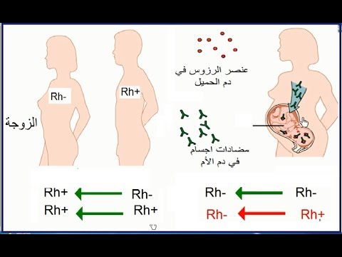 فيديو: ما معنى عامل الريسوس؟