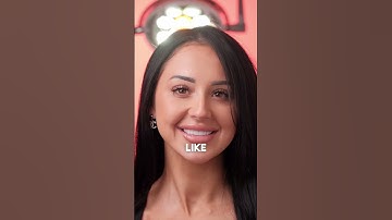 Thumbnail of Brooke's Secret to a Picture-Perfect Smile? Porcelain Veneers from GLO