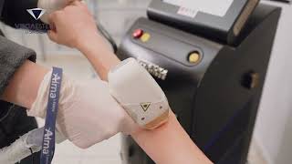 Vega Klinik - Kadın Buz Lazer Epilasyon - Soprano Ice Platinium