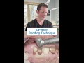 Why precision matters in dental bonding
