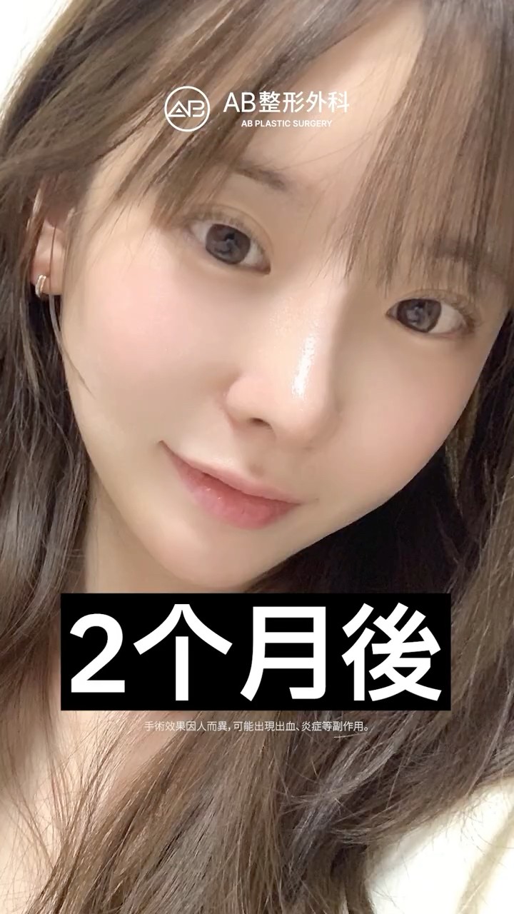 眼睛、鼻子、臉型一起變精緻，整個人都不一樣了💕 #Shorts