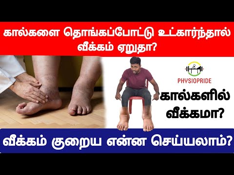 கால்களை தொங்கபோட்டாளோ, நீண்ட நேரம் நின்றுக்கொண்டிருந்தாளோ வீக்கம் அதிகமாகுதா?வீக்கம் குறைய என்ன வழி?