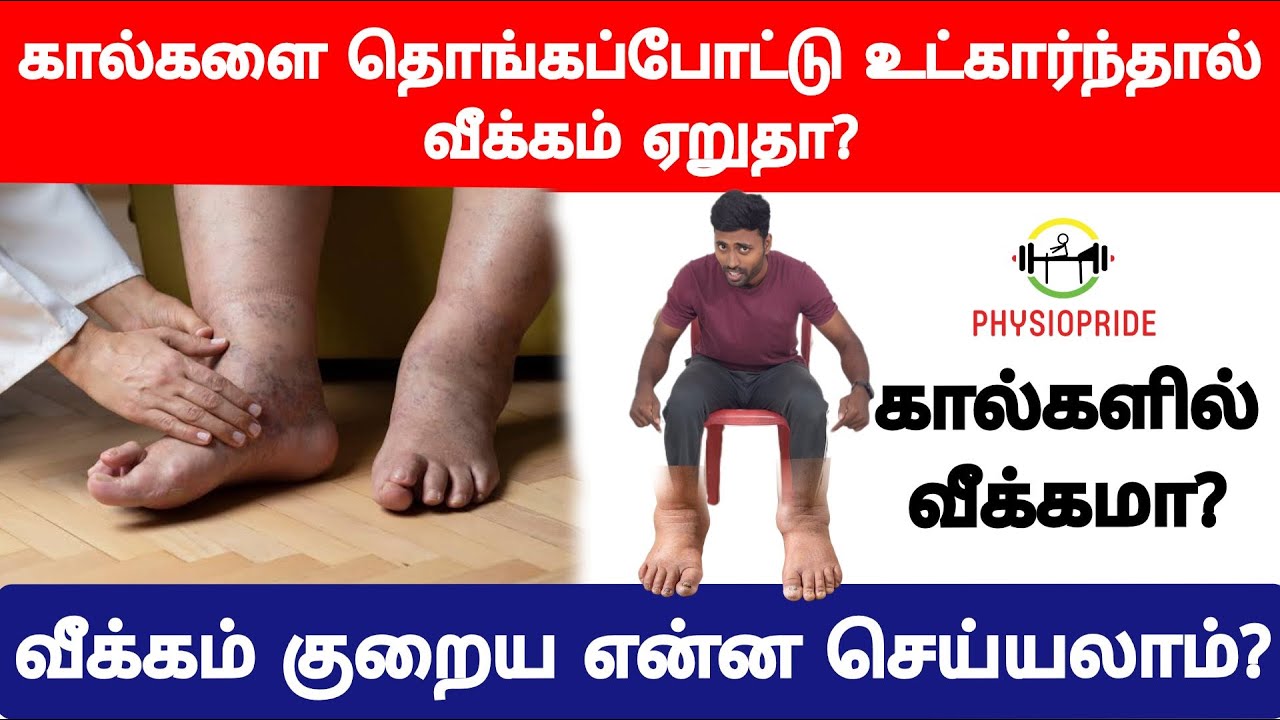 கால்களை தொங்கபோட்டாளோ, நீண்ட நேரம் நின்றுக்கொண்டிருந்தாளோ வீக்கம் அதிகமாகுதா?வீக்கம் குறைய என்ன வழி?