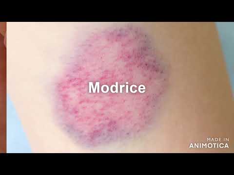 Video: Ali je poliuretan škodljiv za kožo?
