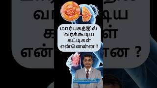 மரபகததல வரககடய கடடகள எனனனன ? Breast Lumps Types