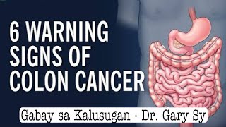 6 Warning Signs of Colon Cancer - Dr. Gary Sy by Gabay sa Kalusugan - Dr. Gary Sy 172,088 views 3 months ago 12 minutes, 48 seconds