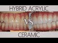 What's the difference between acrylic and ceramic? | Patients Ask