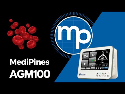 MediPines AGM100 Gas Exchange Measurements Validated Against ABGs (Arterial Blood Gases)