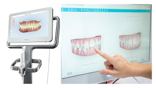 すが歯科クリニック マウスピース矯正専門サイト 月々6 0円