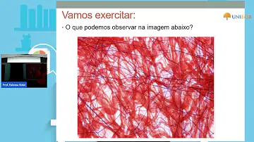 Quais são os principais componentes do tecido conjuntivo?