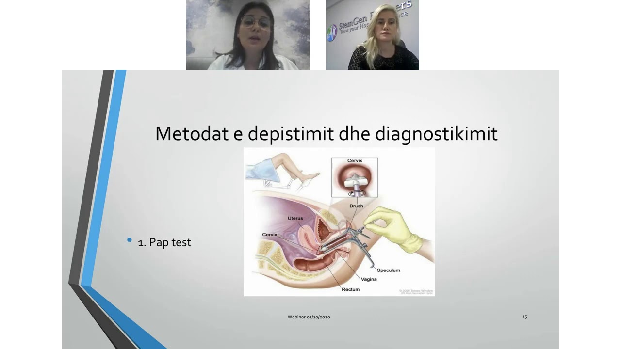 Infeksioni i HPV dhe raportet ne çift: Çfare duhet te dime?