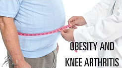 Obesity and knee arthritis