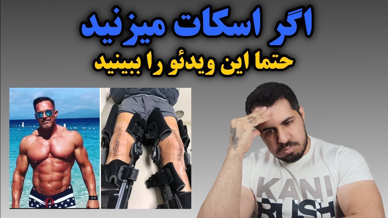 اگر اسکات میزنید حتما این ویدئو را ببینید