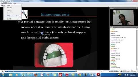 Prosthodontics - Prosthodontics RPD - Rests - Dr. Shweta
