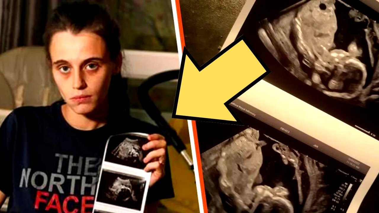 Pregnant Woman Was Told Baby Died in the Womb Next Day Her Intuition ...