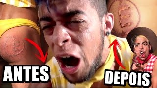 Quentes queimando bochechas