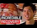 Incredible recovery after world-first limb reattachment surgery | 60 Minutes Australia