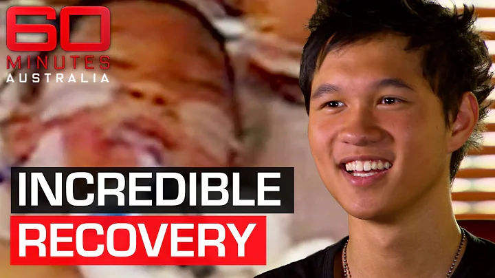 Incredible recovery after world-first limb reattachment surgery | 60 Minutes Australia