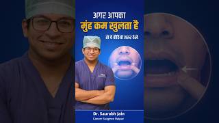 Mouth Not Opening (Muh kam khulna) Due to Gutkha & Tobacco.Dr Saurabh Jain Cancer Doctor Raipur(CG)