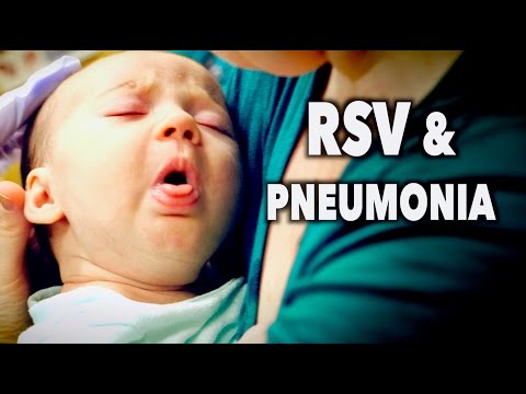 RSV & PNEUMONIA! (2 Month Old Baby) | Dr. Paul