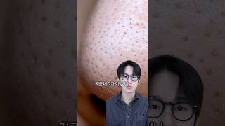 코에 까만 블랙헤드 깔끔하게 관리하는 법