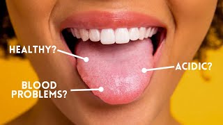 What Your Tongue Says About Your Health | Chinese Tongue Diagnosis & Gut Healing