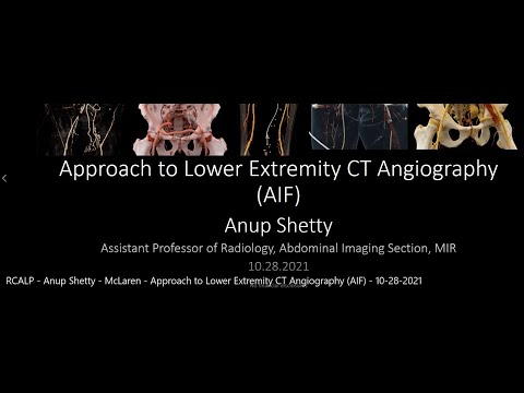Video: Er en cta et angiogram?