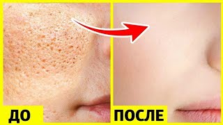 ЖИНСИЙ АЛОҚАДАН КЕЙИНГИ ПАЙДО БЎЛАДИГАН ДОҒЛАРНИ ЙЎҚОТИШ СИРИ ФОШ БЎЛДИ ...