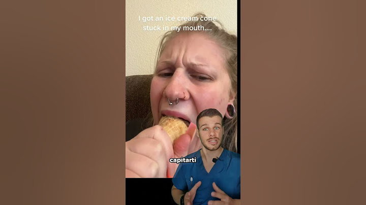 La ragazza con il cono incastrato tra i denti, mandibola lussata⚠️ #shorts