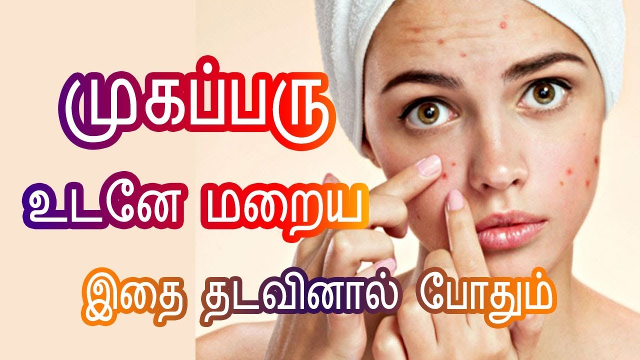 Cure Pimples Overnight in Tamil முகப்பரு உடனே மறைய Pimples treatment in Tamil Tamil beauty