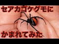 セアカゴケグモに咬まれてみた&amp;食べてみた(毒グモ・外来生物)