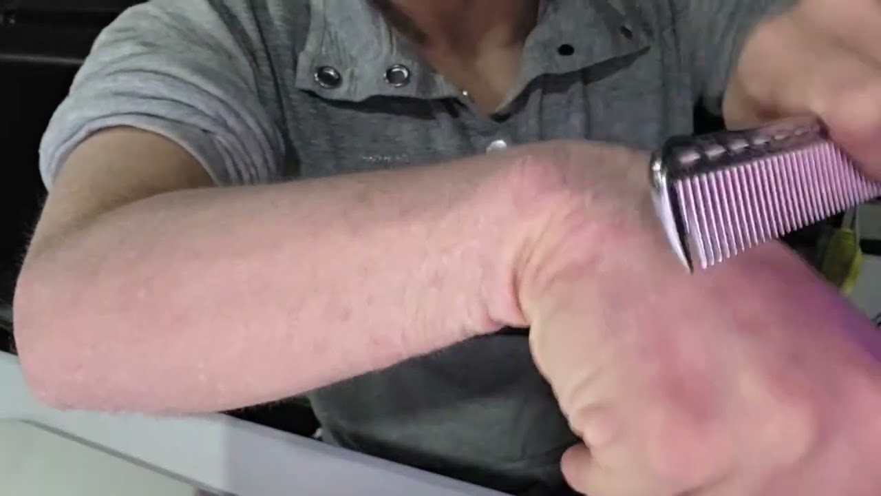 Scratching My Arm HARD W/ Combs(INTENSE)