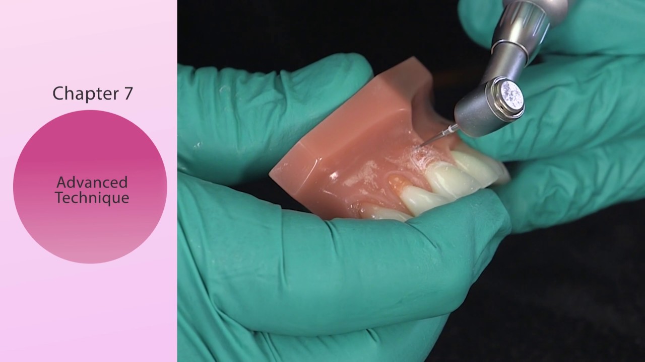 Finishing & Polishing Gingiva Shades