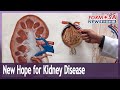 New drug offers fresh hope for treating kidney disease without dialysis