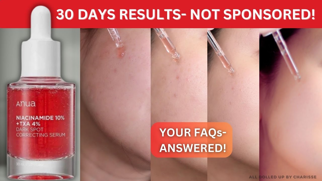 I Used Anua Anua TXA+Niacinamide Dark Spot Serum for 30 Days—Here’s What No One Tells You❗️❗️