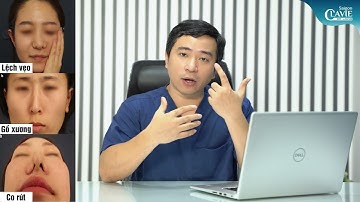 Nâng mũi kín (nâng mũi bán cấu trúc) là gì? Mức độ phù hợp và ưu - nhược điểm | Thẩm mỹ Dr Long
