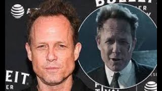 Dean Winters is in constant pain from multiple amputations Content