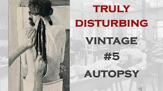 TRULY DISTURBING VINTAGE PHOTOS #5 AUTOPSY REDUX