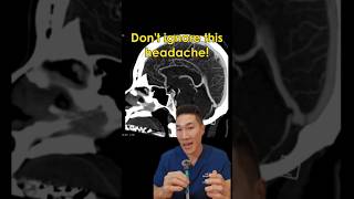 don't ignore this headache!