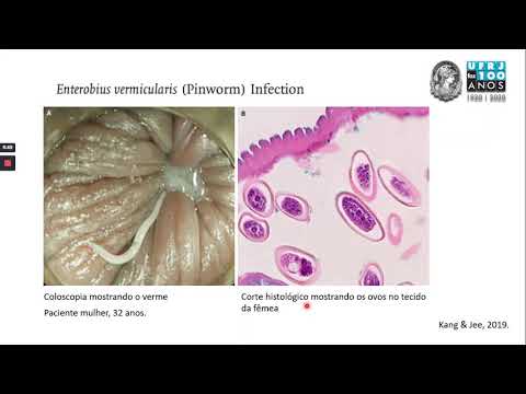 Vídeo: Infecção Por Vermes Espirurídeos Em Répteis