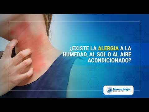 Video: ¿Se puede ser alérgico al aire acondicionado?