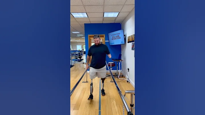 Young Amputee man Stands Strong Again — Inspiring Journey With Advanced Artificial Limbs #armprosthe