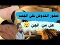 ضهور الخدوش على الجسد هل من الجن إليك الجواب 