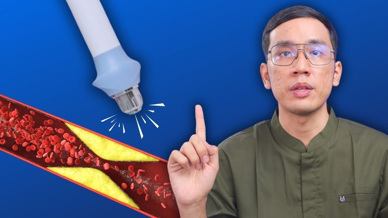 Terapi Impoten Terbaru: Gelombang Kejut EREKSI!