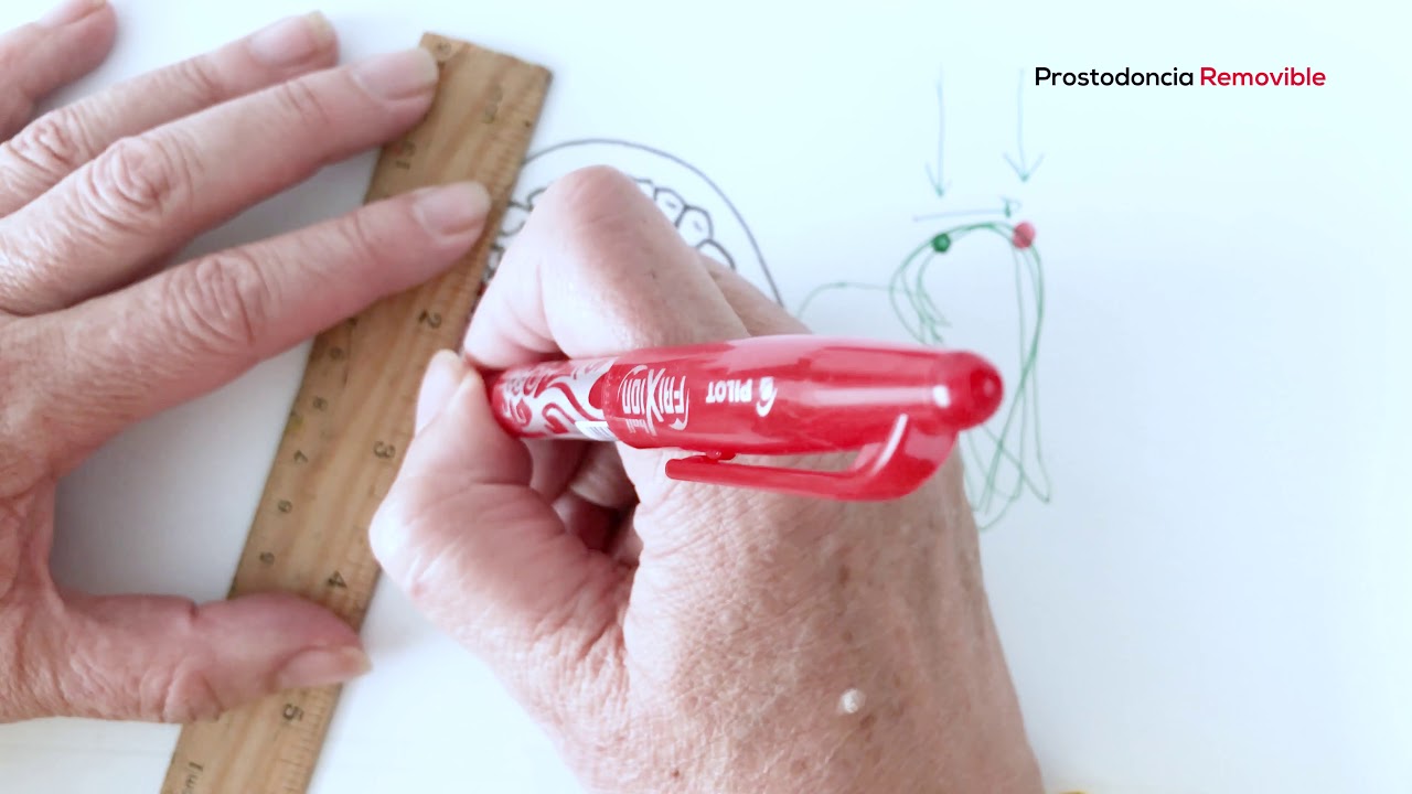 PROSTODONCIA: BIOMECÁNICA CLASE I KENNEDY